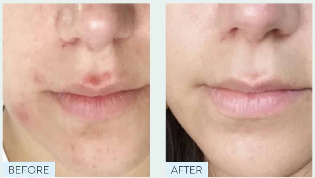 Proven Skincare Review - Must Read This Before Buying